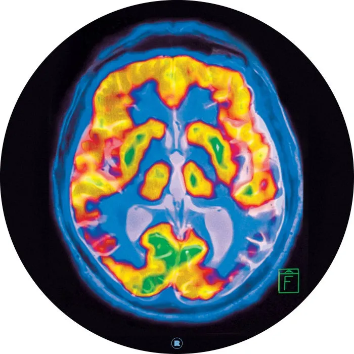 Frankey & Sandrino - Brainscan [REKIDS209]